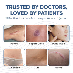 BIODERMIS PROSIL stick travel-friendly packaging supports portable scar therapy.