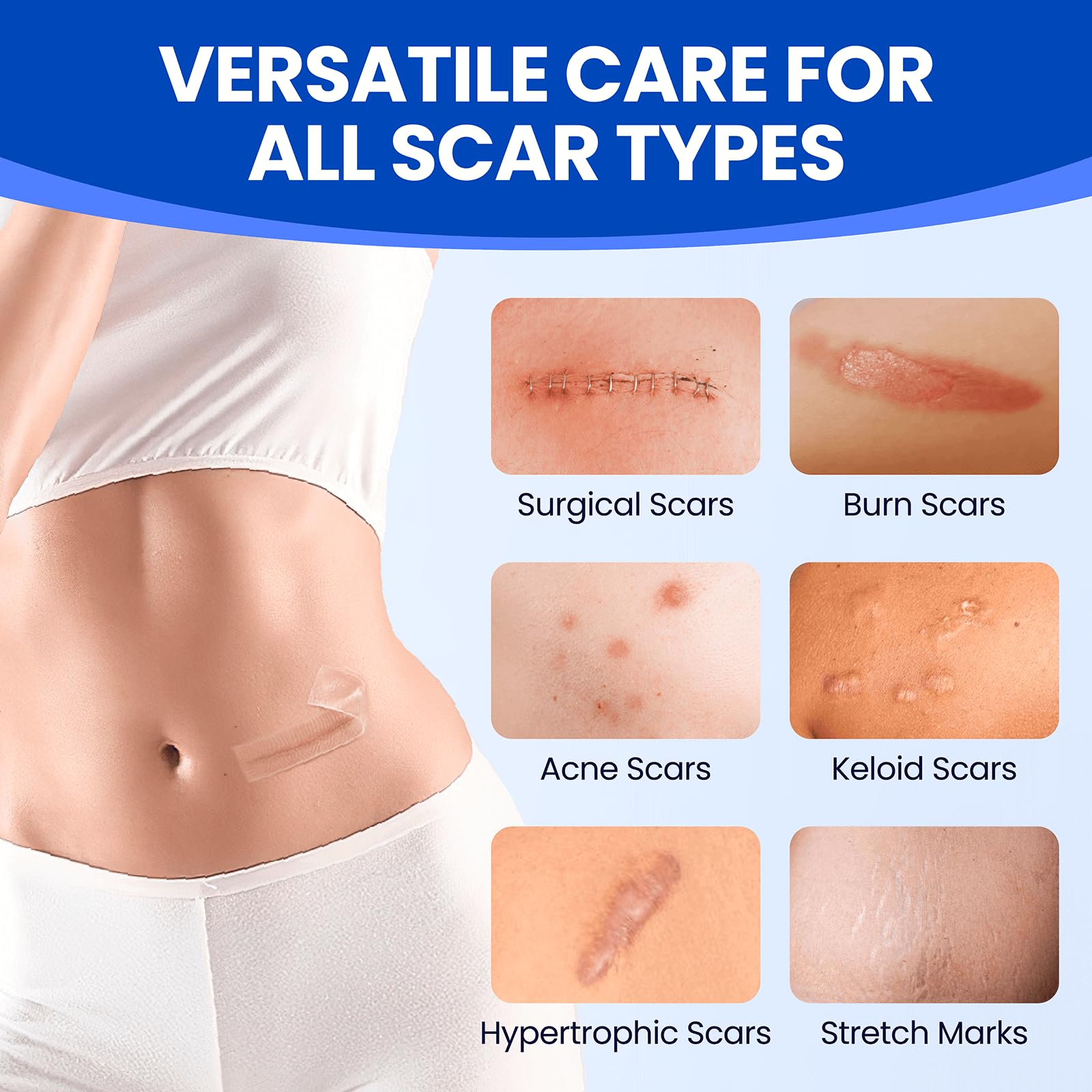 Bioemmalab silicone scar sheets skin-tone blend for discreet facial scar coverage.