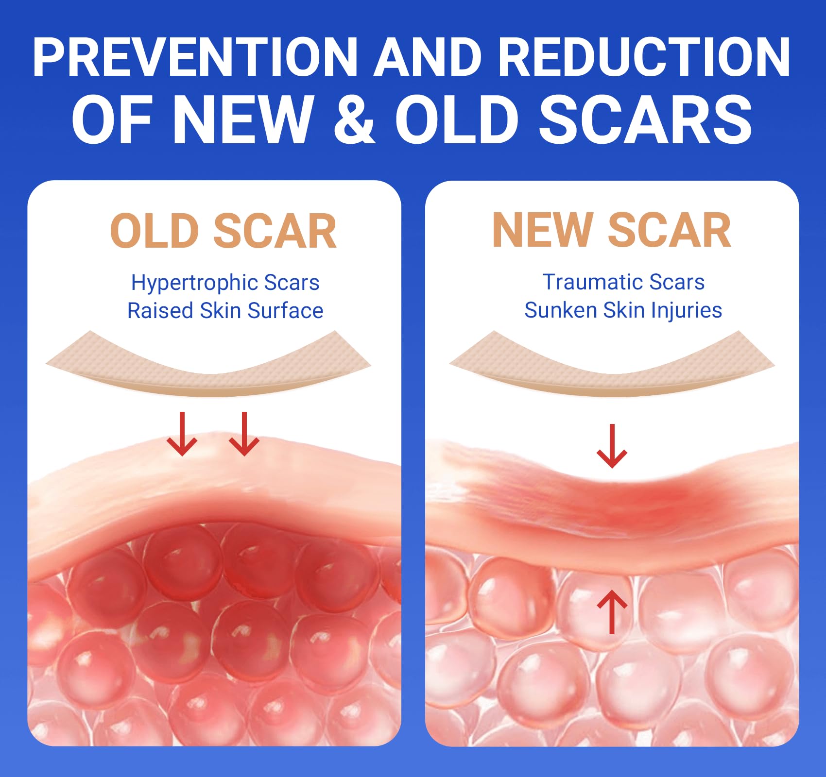 Bioemmalab silicone scar sheets adhesion close-up highlighting secure wear during activities.