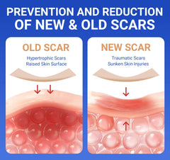 Bioemmalab silicone scar sheets adhesion close-up highlighting secure wear during activities.