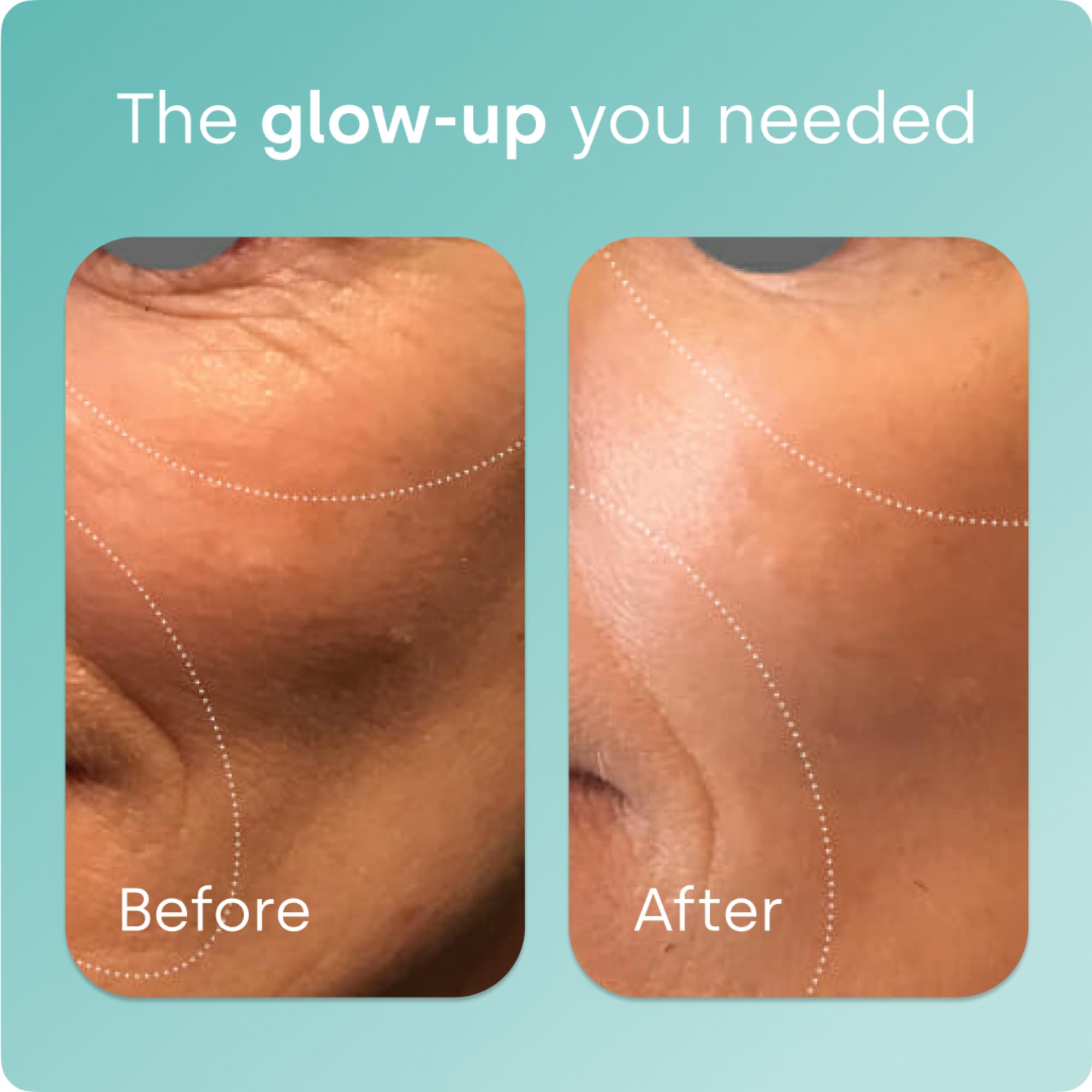 Biosil Collagen Booster bottle showcasing the label