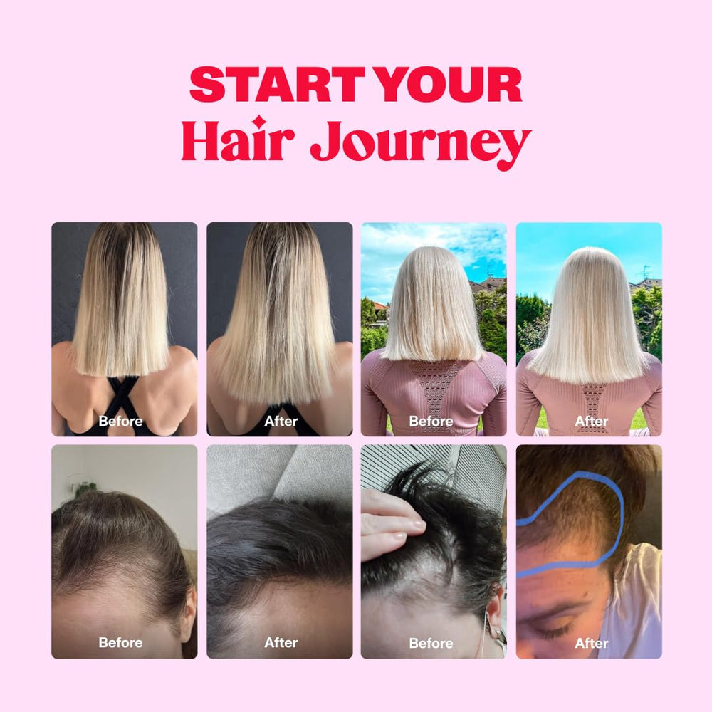Postnatal hair support image featuring Bloom Robbins gummies