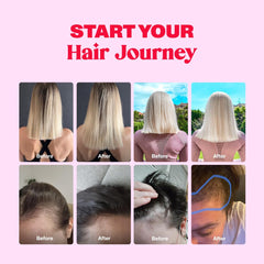 Postnatal hair support image featuring Bloom Robbins gummies