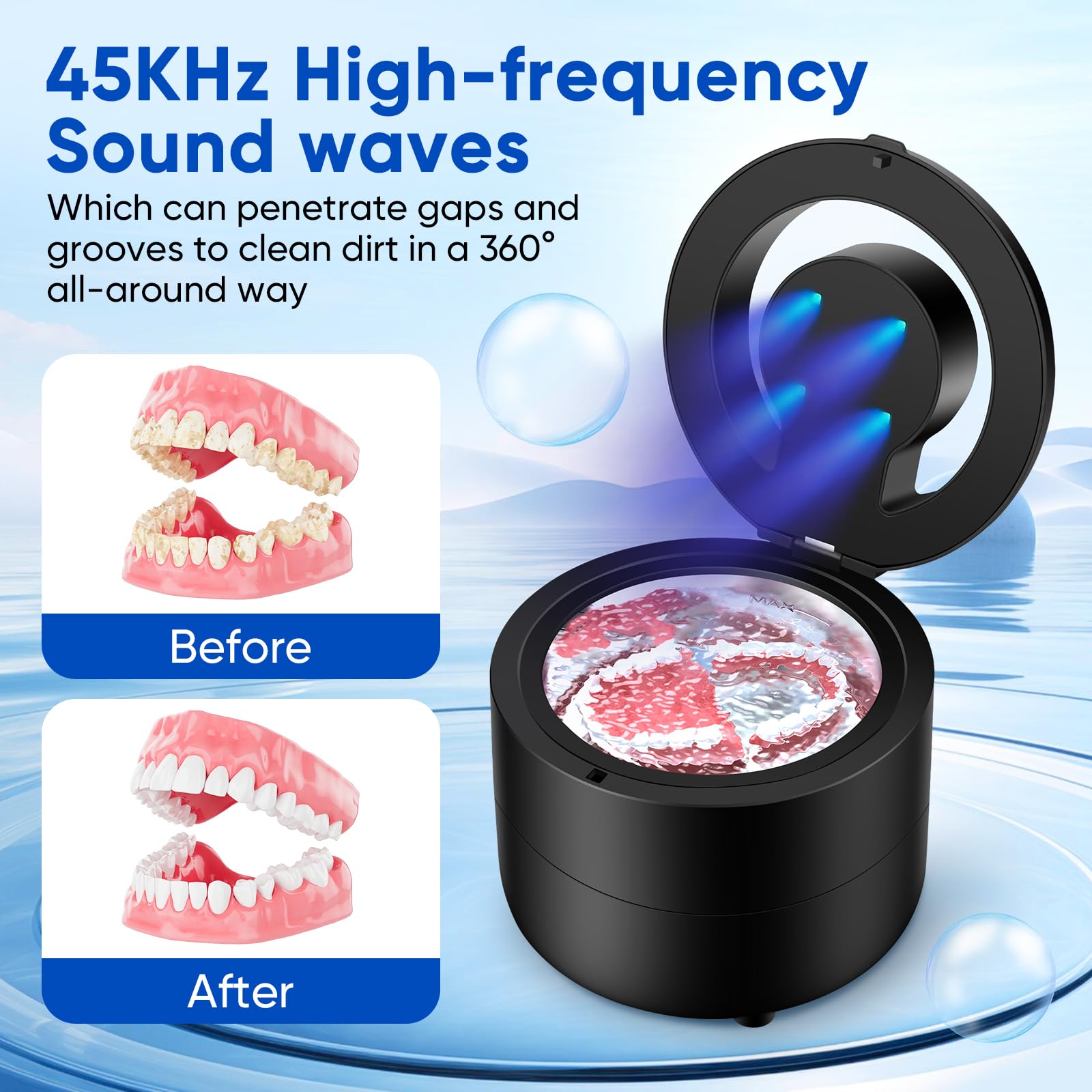 Illustration of 45kHz cleaning waves penetrating dentures and braces