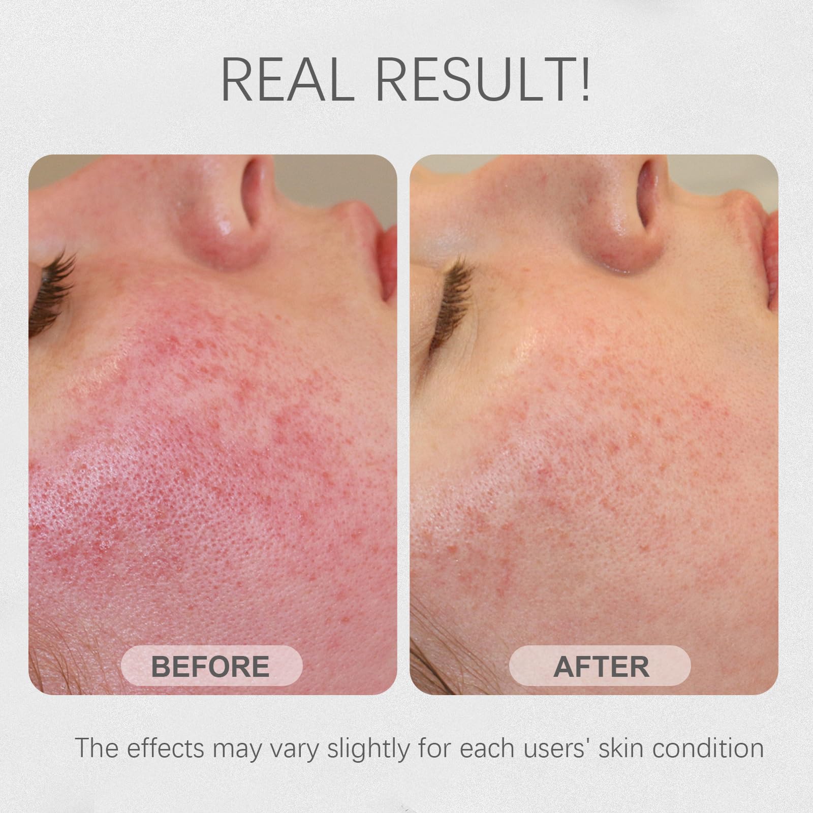Bmrewax Rice Mask promotes natural glow and refined pores.