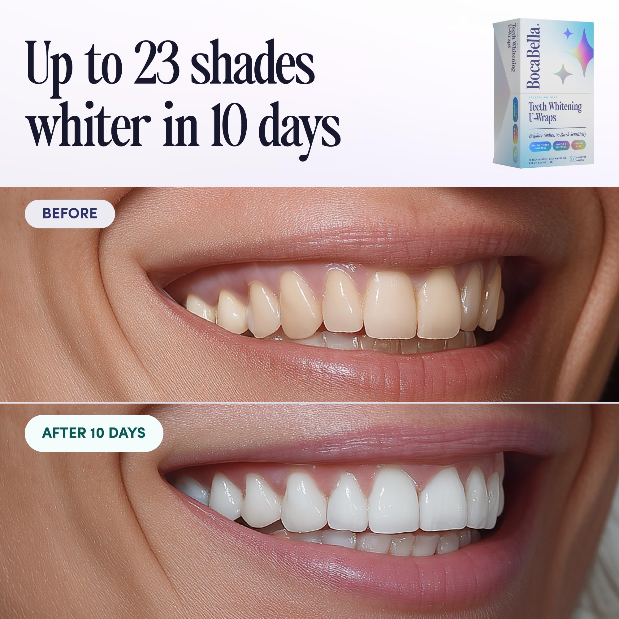Close-up of whitening strip on front teeth