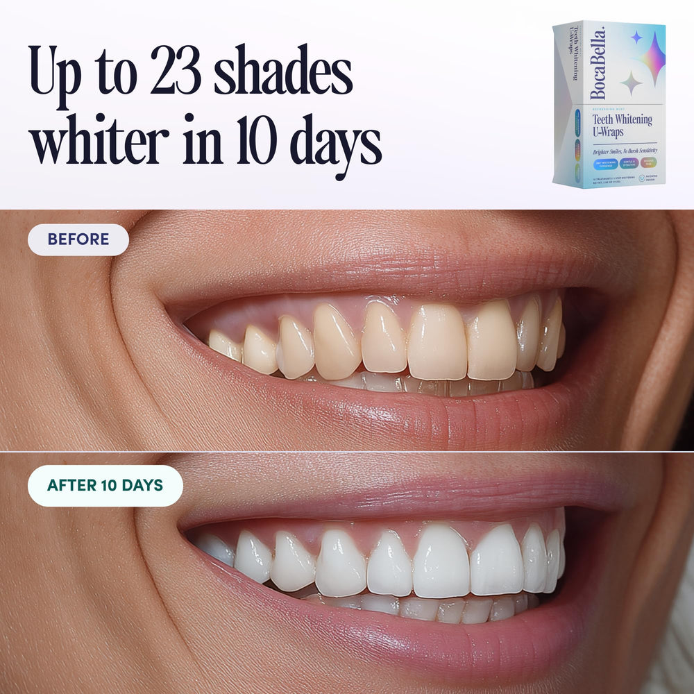 Close-up of whitening strip on front teeth