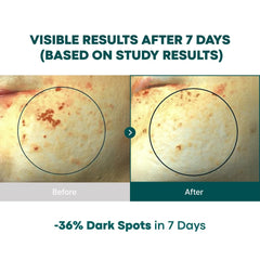 BONCEPT Vita C serum texture showcases light non sticky hydration upon application