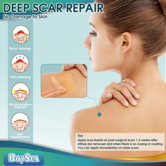 Boysea scar sheets packaged box emphasizes easy storage and reuse