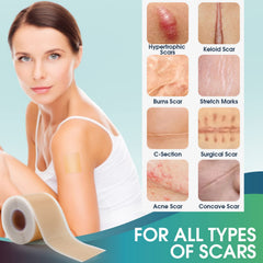 Boysea silicone scar sheets on skin applying show gentle non-irritating coverage