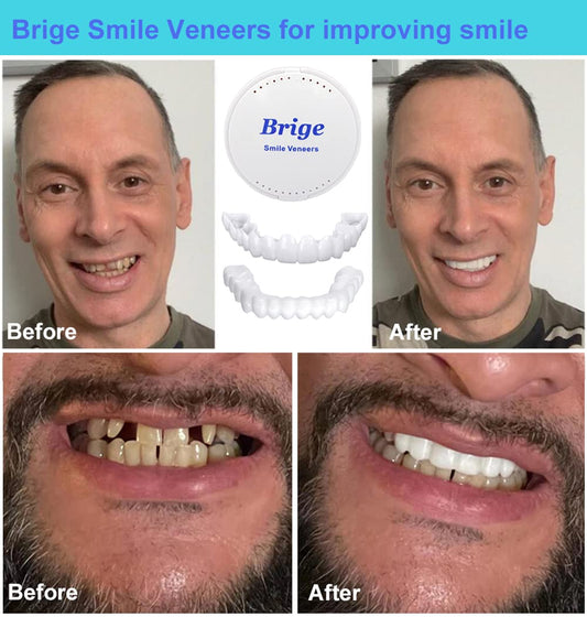 Brige Smile temporary denture bottom unit