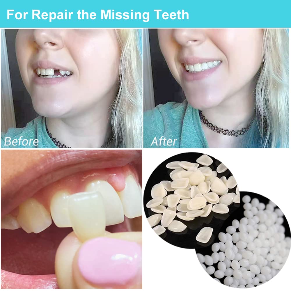 Close-up of thermal beads for the tooth repair kit