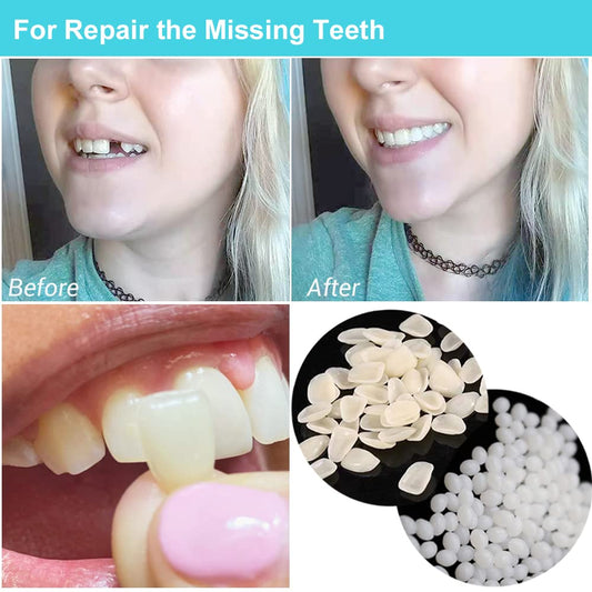 Close-up of thermal beads for the tooth repair kit