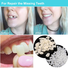 Close-up of thermal beads for the tooth repair kit