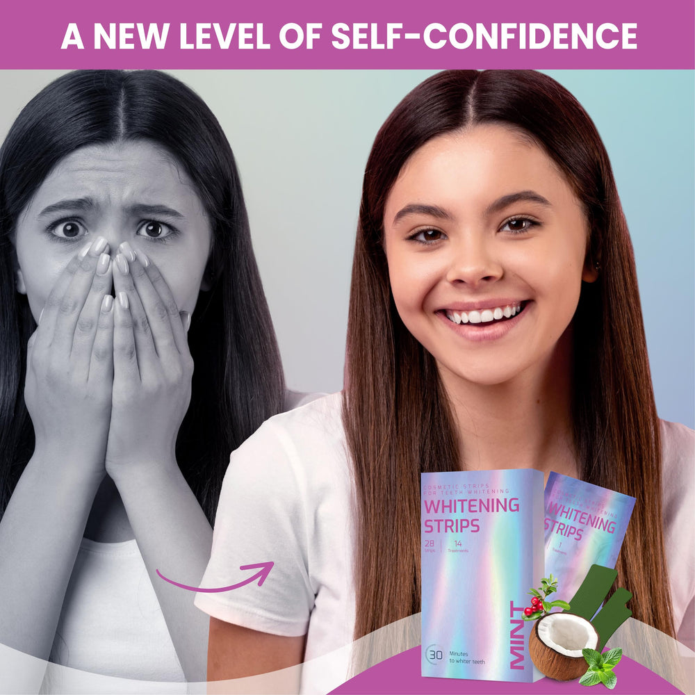 Bright, radiant smile after whitening