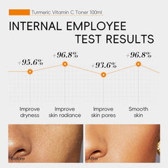 BSMKCL Turmeric Toner demonstrates oil control after application