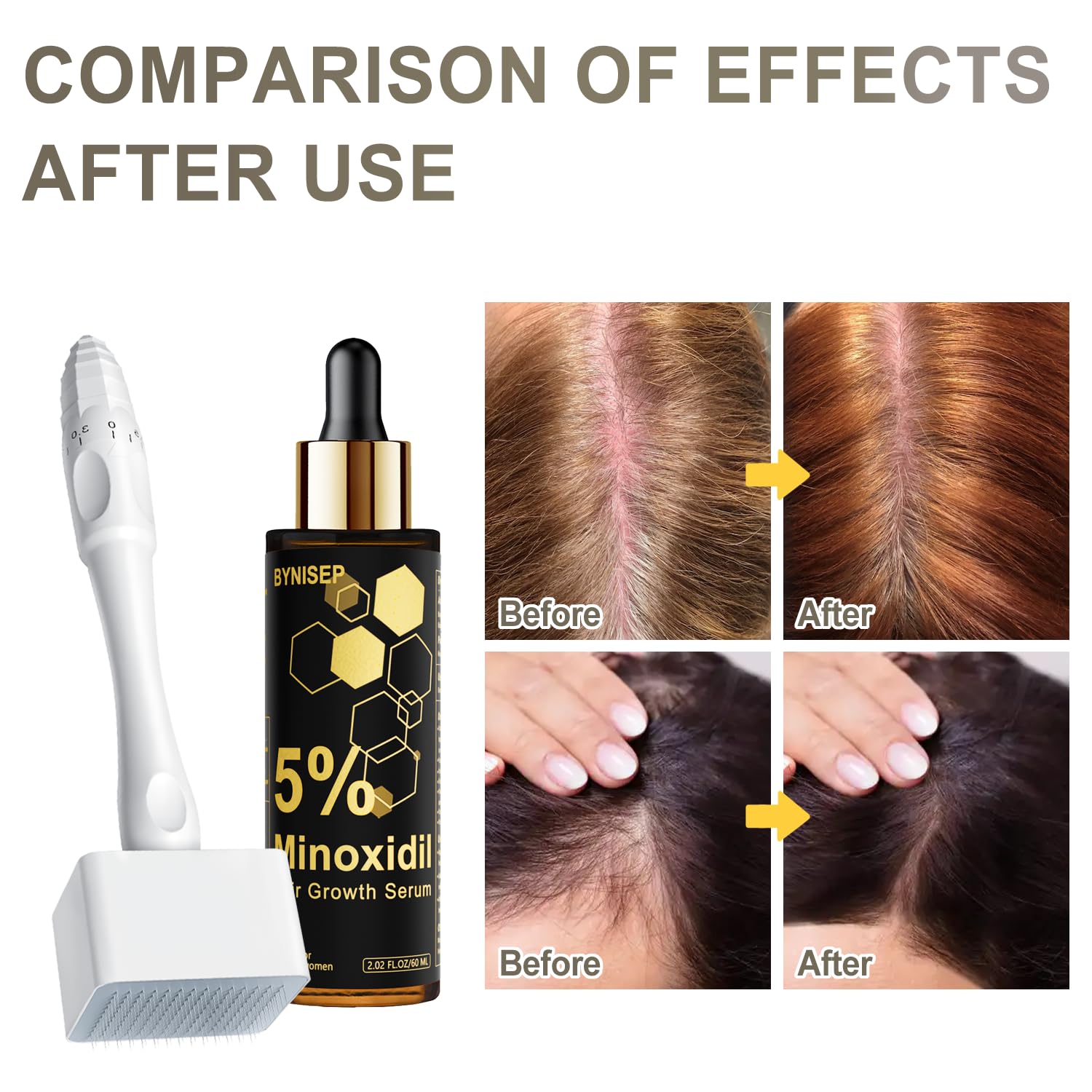 BYNISEP minoxidil serum full bottle 60ml on a clean surface.