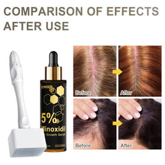 BYNISEP minoxidil serum full bottle 60ml on a clean surface.
