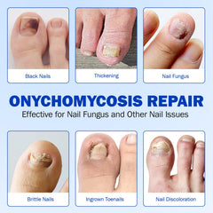 Cacukn 21-patch pack ready for overnight nail renewal.