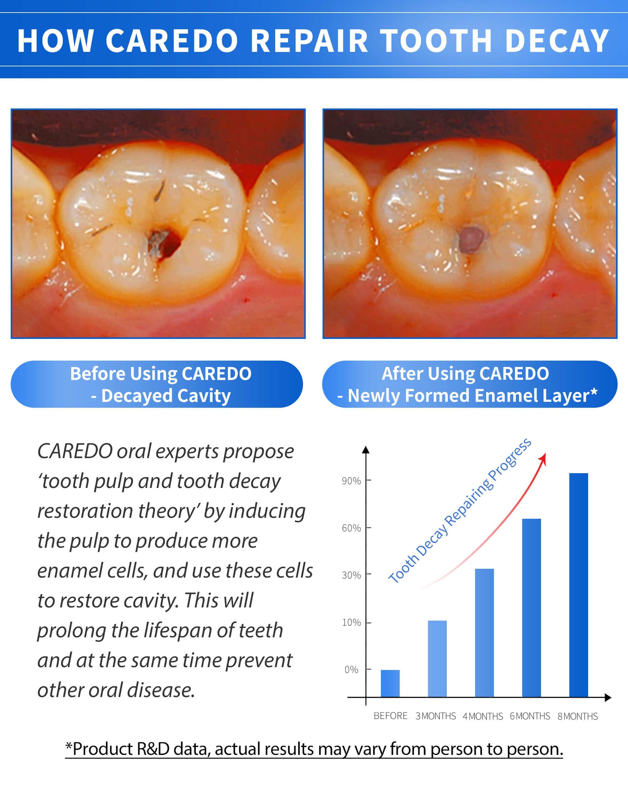 CAREDO pulpitis discomfort ointment 16g tube
