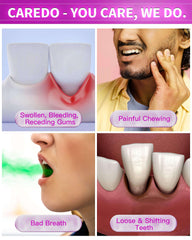 CAREDO toothpaste supporting receding gums treatment