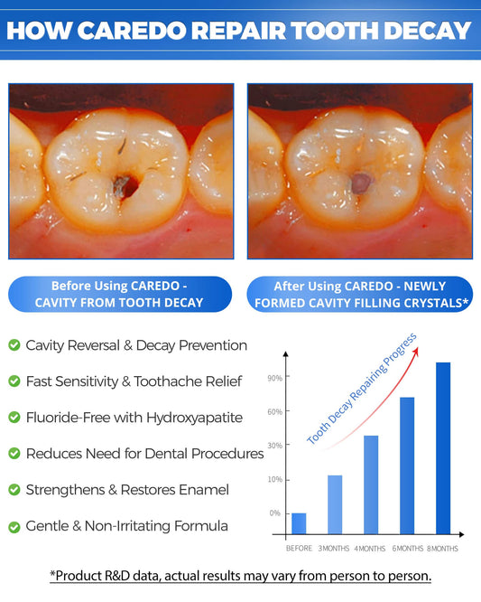 Tube of CAREDO cavity reversal toothpaste