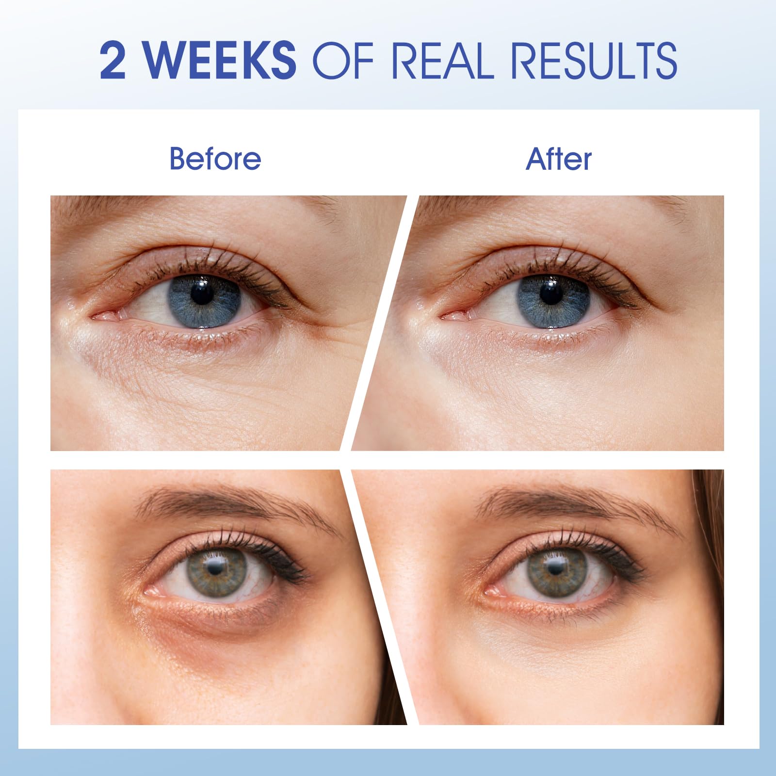 Ceedoo Eye Cream with caffeine brightens under-eye area