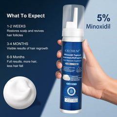 Celtrum Minoxidil Foam application on the scalp for twice-daily use.