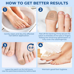 CFKDY nail discoloration improvement – fade discoloration over time.