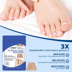 CFKDY overnight renewal patches – reinforce nail health while you sleep.