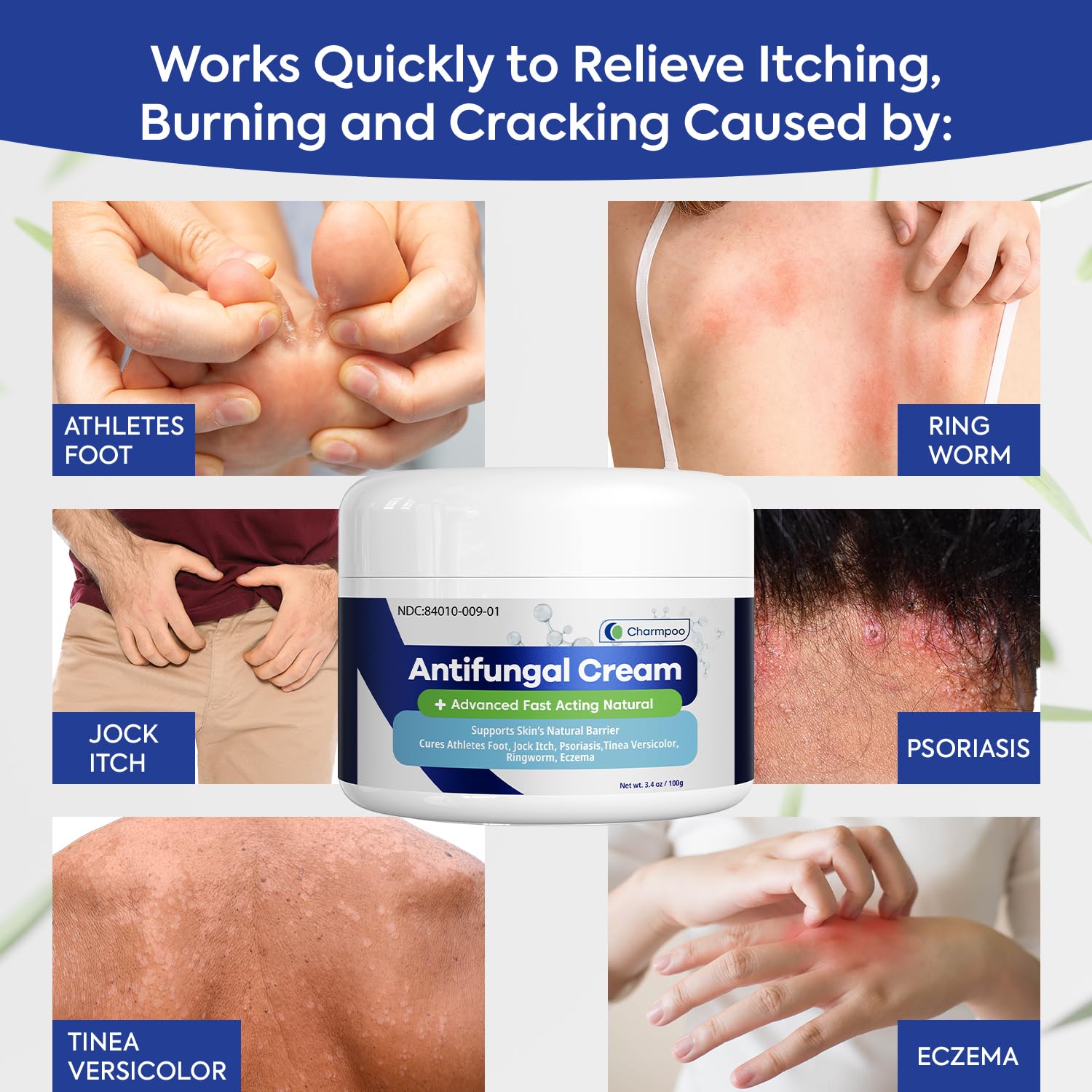 CHARMPOO antifungal cream tube close-up shows easy-dispense design for quick itch relief.