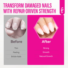 CHUCHU Nail Ridge Filler on a damaged nail showcases smooth finish