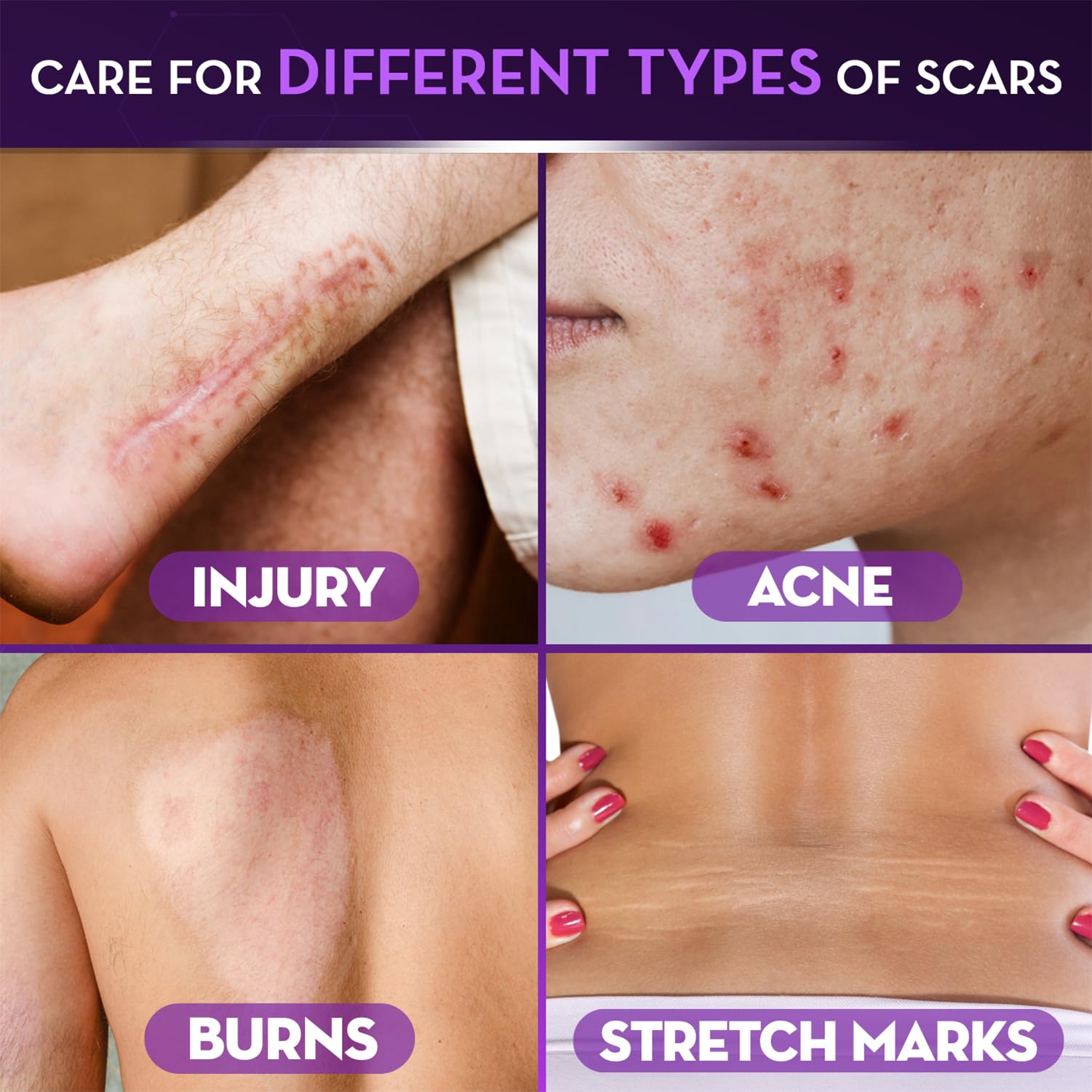 Cicatricure Advanced Scar Gel closeup reveals clear quickly absorbing texture