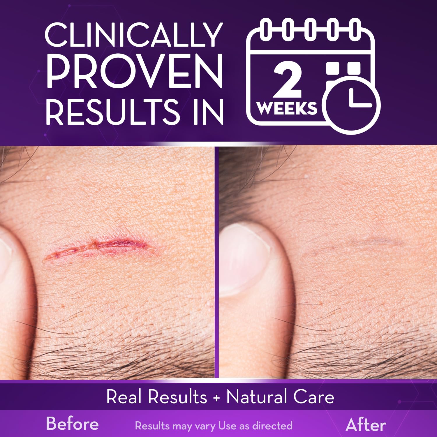 Cicatricure Advanced Scar Gel texture-application demonstrates quick-absorbing, non-greasy feel
