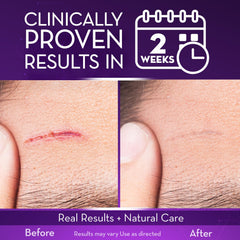 Cicatricure Advanced Scar Gel texture-application demonstrates quick-absorbing, non-greasy feel
