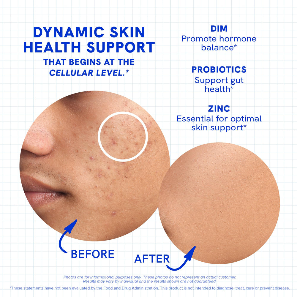 Probiotic and label information on Clear Skin Supplement