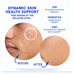 Probiotic and label information on Clear Skin Supplement