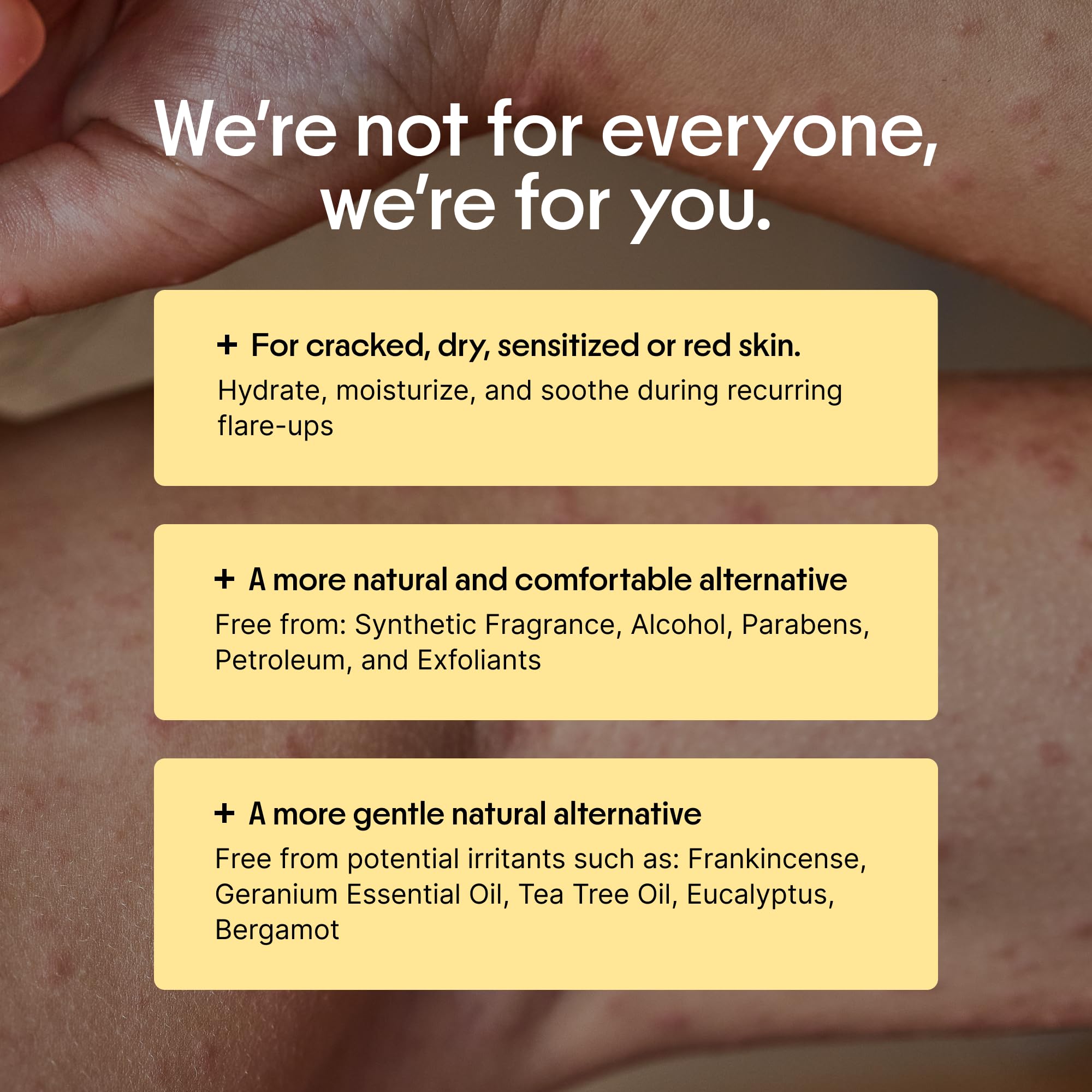 Eczema-area care with Clearbody Organics Manuka Honey Cream impression