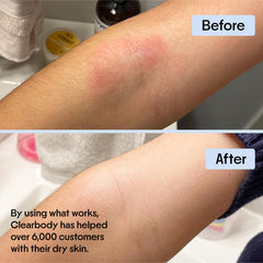 Clearbody Organics Manuka Honey Cream travel-size tube for on-the-go care.