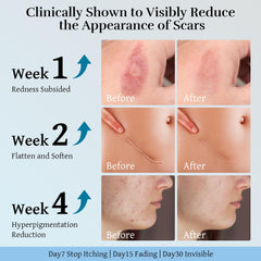 CLNABFR scar cream being applied to skin to illustrate daily routine.