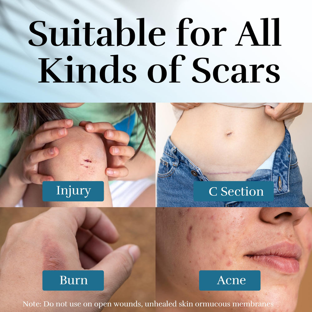 CLNABFR texture-swatch demonstrating creamy gel formula for sensitive scars.