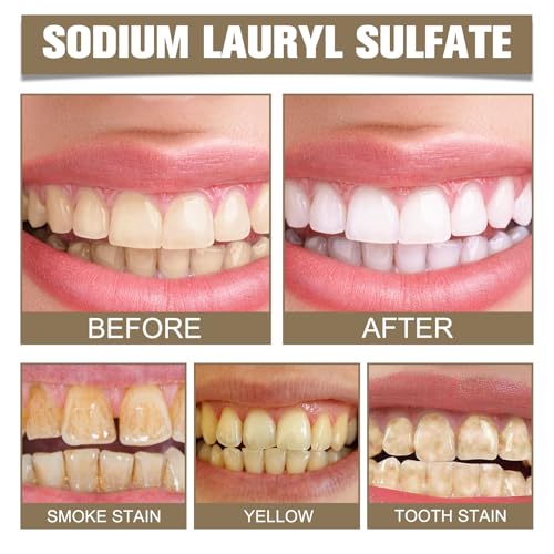 Illustration showing coffee, tea, and wine stain removal for teeth