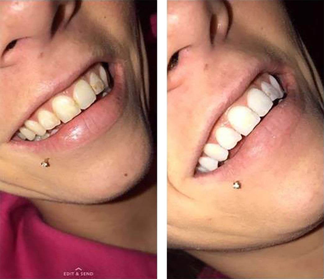 Purple gel from Color Wheel Teeth Whitener Mint displaying color