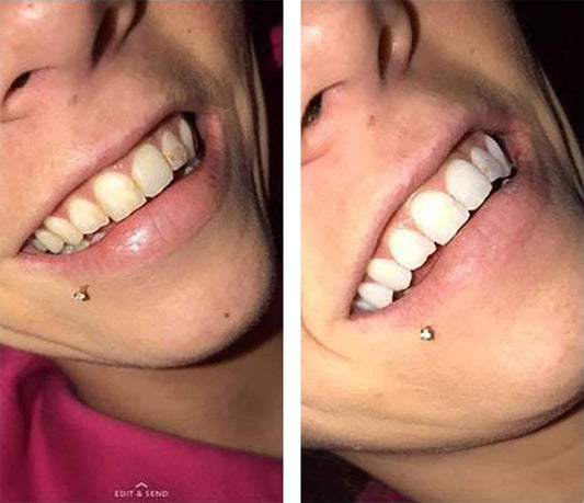 Purple gel from Color Wheel Teeth Whitener Mint displaying color