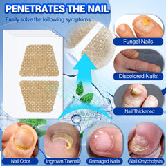 Comfort Toenail Fungus Patch Application Hand demonstrates easy patch placement.