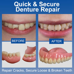 Complete denture repair kit with glue, micro brush, gloves