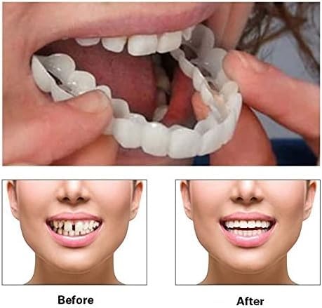 Confident natural smile with white aligners
