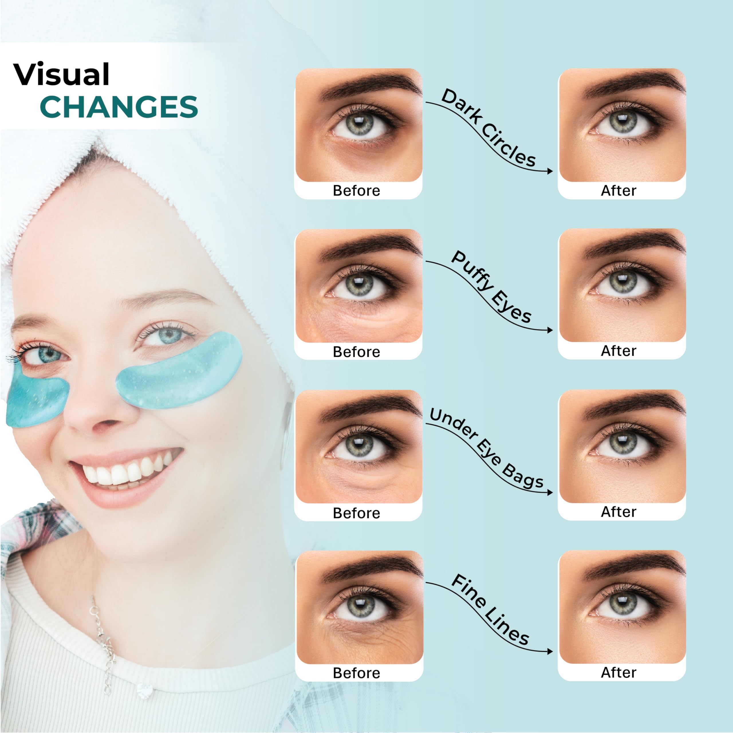 Cornice hydrogel patches close-up provide moisture and smoother skin.