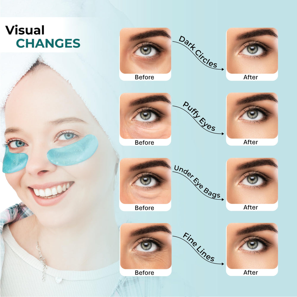 Cornice hydrogel patches close-up provide moisture and smoother skin.