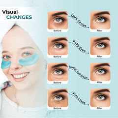 Cornice hydrogel patches close-up provide moisture and smoother skin.